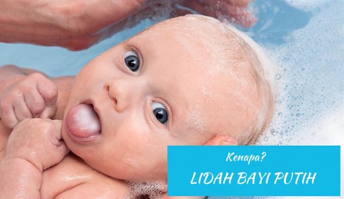 penyebab lidah putih pada bayi