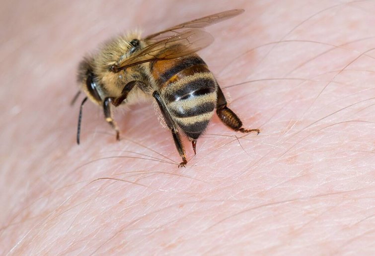 Cara mengobati sengatan lebah