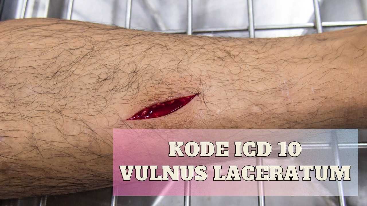 kode icd 10 vulnus laceratum